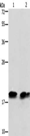 Gel: 12%SDS-PAGE, Lysate: 40 μg, Lane 1-2: Mouse brain tissue, NIH/3T3 cells, Primary antibody: SKP1 Antibody(SKP1 Antibody) at dilution 1/550, Secondary antibody: Goat anti rabbit IgG at 1/8000 dilution, Exposure time: 20 secondsRabbit anti-Human SKP1 Polyclonal Antibody