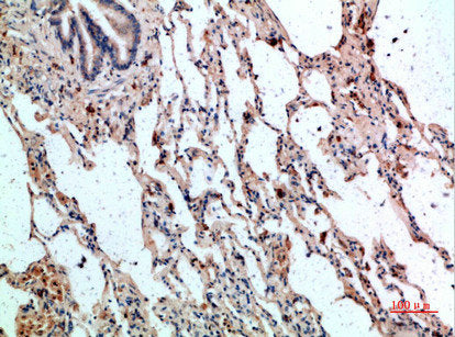Immunohistochemical analysis of paraffin-embedded human-lung, antibody was diluted at 1:200Rabbit anti-Human GYPC Polyclonal Antibody