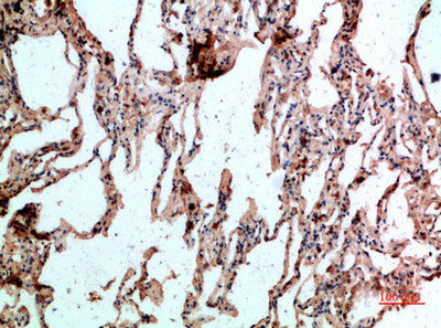 Immunohistochemical analysis of paraffin-embedded human-lung, antibody was diluted at 1:200Rabbit anti-Human GYPC Polyclonal Antibody