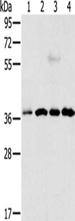 Gel: 12%SDS-PAGE, Lysate: 40 μg, Lane 1-4: Hela cells, Jurkat cells, 293T cells, 231 cells, Primary antibody: VEGFA Antibody(VEGFA Antibody) at dilution 1/300, Secondary antibody: Goat anti rabbit IgG at 1/8000 dilution, Exposure time: 50 secondsRabbit anti-Human VEGFA Polyclonal Antibody