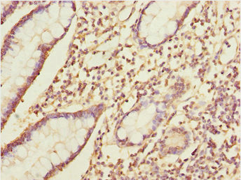 Immunohistochemistry of paraffin-embedded human small intestine tissue using IKBIP Antibody at dilution of 1:100Rabbit anti-Human IKBIP Polyclonal Antibody