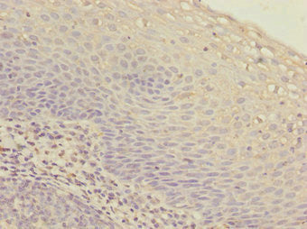 Immunohistochemistry of paraffin-embedded human tonsil tissue using IKBIP Antibody at dilution of 1:100Rabbit anti-Human IKBIP Polyclonal Antibody