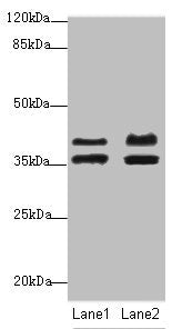 Western blot | All lanes: IKBIPantibody at 2.23μg/ml | Lane 1: Mouse kidney tissue | Lane 2: HL60 whole cell lysate | Secondary | Goat polyclonal to rabbit IgG at 1/10000 dilution | Predicted band size: 40, 28, 8, 44 kDa | Observed band size: 40, 36 kDaRabbit anti-Human IKBIP Polyclonal Antibody