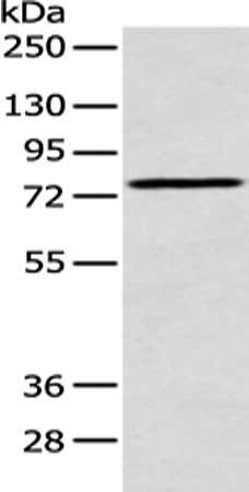 Gel: 8%SDS-PAGE, Lysate: 40 μg, Lane: Human normal kidney tissue, Primary antibody: ACSM5 Antibody(ACSM5 Antibody) at dilution 1/200 dilution, Secondary antibody: Goat anti rabbit IgG at 1/8000 dilution, Exposure time: 30 seconds