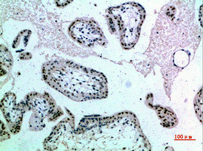 Immunohistochemical analysis of paraffin-embedded human-placenta, antibody was diluted at 1:200Rabbit anti-Human NOP56 Polyclonal Antibody