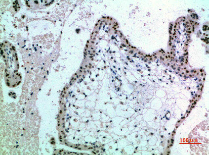Immunohistochemical analysis of paraffin-embedded human-placenta, antibody was diluted at 1:200Rabbit anti-Human NOP56 Polyclonal Antibody