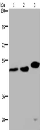Gel: 8%SDS-PAGE, Lysate: 40 μg, Lane 1-3: Hela cells, 293T cells, mouse liver tissue, Primary antibody: TDP2 Antibody(TDP2 Antibody) at dilution 1/200, Secondary antibody: Goat anti rabbit IgG at 1/8000 dilution, Exposure time: 6 minutesRabbit anti-Human TDP2 Polyclonal Antibody