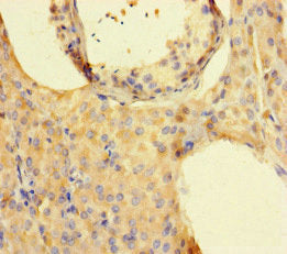 Immunohistochemistry of paraffin-embedded human testis tissue using ISPD Antibody at dilution of 1:100