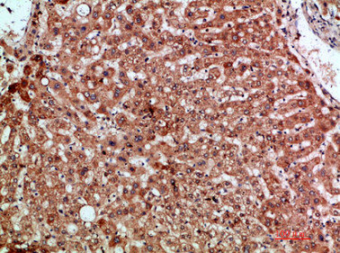 Immunohistochemical analysis of paraffin-embedded human-liver, antibody was diluted at 1:200Rabbit anti-Human CCL20 Polyclonal Antibody