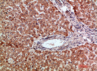 Immunohistochemical analysis of paraffin-embedded human-liver, antibody was diluted at 1:200Rabbit anti-Human CCL20 Polyclonal Antibody