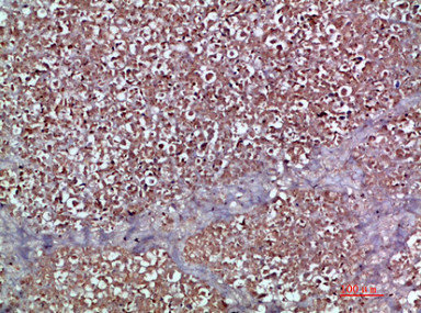 Immunohistochemical analysis of paraffin-embedded human-pancreas, antibody was diluted at 1:200Rabbit anti-Human CCL20 Polyclonal Antibody