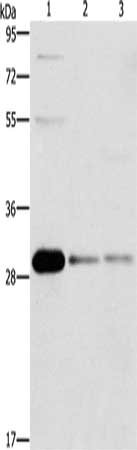 Gel: 10%SDS-PAGE, Lysate: 40 μg, Lane 1-3: HepG2 cells, Raji cells, 293T cells, Primary antibody: BCL10 Antibody(BCL10 Antibody) at dilution 1/950, Secondary antibody: Goat anti rabbit IgG at 1/8000 dilution, Exposure time: 40 seconds