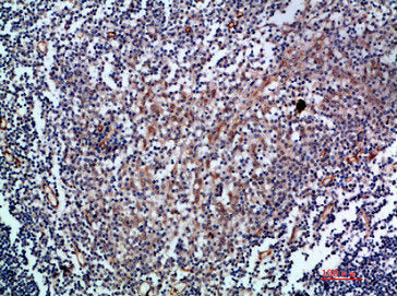 Immunohistochemical analysis of paraffin-embedded human-tonsil, antibody was diluted at 1:200Rabbit anti-Human ENG Polyclonal Antibody