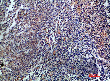 Immunohistochemical analysis of paraffin-embedded human-tonsil, antibody was diluted at 1:200Rabbit anti-Human ENG Polyclonal Antibody