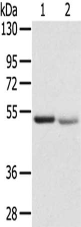 Gel: 8%SDS-PAGE,Lysate: 40 μg,Lane 1-2: Human placenta tissue, Human normal kidney tissue,Primary antibody: SLC8B1 Antibody(SLC8B1 Antibody) at dilution 1/200 dilution,Secondary antibody: Goat anti rabbit IgG at 1/8000 dilution,Exposure time: 1 minute