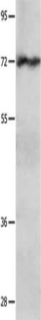 Gel: 10%SDS-PAGE, Lysate: 50 μg, Lane: Hela cells, Primary antibody: IGF2BP1 Antibody(IGF2BP1 Antibody) at dilution 1/750, Secondary antibody: Goat anti rabbit IgG at 1/8000 dilution, Exposure time: 1 minuteRabbit anti-Human IGF2BP1 Polyclonal Antibody