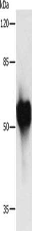 Gel: 10%SDS-PAGE, Lysate: 2 μg, Lane: Recombinant HA tagged protein, Primary antibody: MYC Antibody(c-Myc Tag Antibody) at dilution 1/1000, Secondary antibody: Goat anti rabbit IgG at 1/8000 dilution, Exposure time: 1 secondRabbit anti-Human MYC Polyclonal Antibody