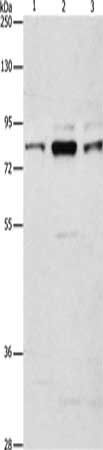 Gel: 8%SDS-PAGE, Lysate: 40 μg, Lane 1-3: Human brain malignant glioma tissue, A172 cells, 293T cells, Primary antibody: ARHGEF7 Antibody(ARHGEF7 Antibody) at dilution 1/800, Secondary antibody: Goat anti rabbit IgG at 1/8000 dilution, Exposure time: 3 minutesRabbit anti-Human ARHGEF7 Polyclonal Antibody