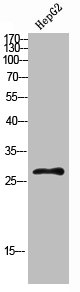 Western Blot analysis of HEPG2 cells using CLECSF6 Polyclonal Antibody diluted at 1:500. Secondary antibody  was diluted at 1:20000Rabbit anti-Human CLEC4A Polyclonal Antibody