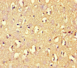 Immunohistochemistry of paraffin-embedded human brain tissue using ARHGAP42 Antibody at dilution of 1:100Rabbit anti-Human ARHGAP42 Polyclonal Antibody