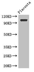 Western Blot | Positive WB detected in: Human placenta tissue | All lanes: ARHGAP42 antibody at 2.8μg/ml | Secondary | Goat polyclonal to rabbit IgG at 1/50000 dilution | Predicted band size: 99 kDa | Observed band size: 99 kDaRabbit anti-Human ARHGAP42 Polyclonal Antibody