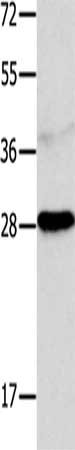 Gel: 12%SDS-PAGE, Lysate: 40 μg, Lane: 231 cells, Primary antibody: NTF4 Antibody(NTF4 Antibody) at dilution 1/300, Secondary antibody: Goat anti rabbit IgG at 1/8000 dilution, Exposure time: 2 minutesRabbit anti-Human NTF4 Polyclonal Antibody