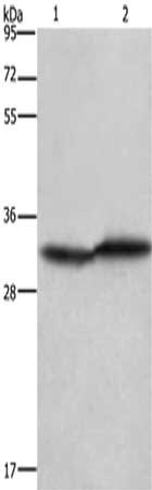 Gel: 10%SDS-PAGE,Lysate: 40 μg,Lane 1-2: Jurkat cells, 293T cells,Primary antibody: CASP3 Antibody(CASP3 Antibody) at dilution 1/400 dilution,Secondary antibody: Goat anti rabbit IgG at 1/8000 dilution,Exposure time: 10 seconds