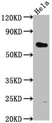 Western Blot | Positive WB detected in: Hela whole cell lysate | All lanes: USP17L5 antibody at 1:2000 | Secondary | Goat polyclonal to rabbit IgG at 1/50000 dilution | Predicted band size: 60 kDa | Observed band size: 60 kDaRabbit anti-Human USP17L5 Polyclonal Antibody