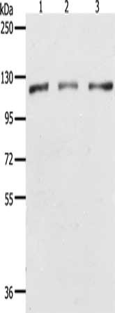 Gel: 8%SDS-PAGE, Lysate: 40 μg, Lane 1-3: Hela cells, K562 cells, Jurkat cells, Primary antibody: PARP1 Antibody(PARP1 Antibody) at dilution 1/350, Secondary antibody: Goat anti rabbit IgG at 1/8000 dilution, Exposure time: 1 secondRabbit anti-Human PARP1 Polyclonal Antibody
