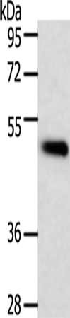 Gel: 10%SDS-PAGE, Lysate: 40 μg, Lane: Human lymphoma tissue, Primary antibody: TRAF1 Antibody(TRAF1 Antibody) at dilution 1/350, Secondary antibody: Goat anti rabbit IgG at 1/8000 dilution, Exposure time: 10 secondsRabbit anti-Human TRAF1 Polyclonal Antibody