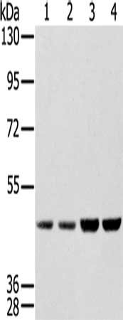 Gel: 8%SDS-PAGE, Lysate: 40 μg, Lane 1-4: Hela cells, Raji cells, 231 cells, K562 cells, Primary antibody: SSB Antibody(SSB Antibody) at dilution 1/400, Secondary antibody: Goat anti rabbit IgG at 1/8000 dilution, Exposure time: 10 secondsRabbit anti-Human SSB Polyclonal Antibody