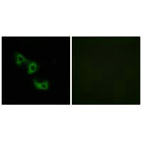 Immunofluorescence analysis of HuvEc cells, using MRPL44 antibody.Rabbit anti-Human MRPL44 Polyclonal Antibody