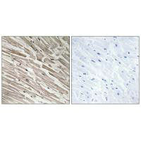 Immunohistochemistry analysis of paraffin-embedded human heart tissue using MRPL44 antibody.Rabbit anti-Human MRPL44 Polyclonal Antibody