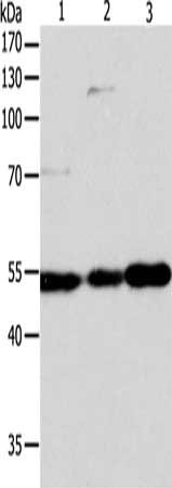 Gel: 10%SDS-PAGE, Lysate: 40 μg, Lane 1-3: Jurkat cells, Hela cells, A549 cells, Primary antibody: GSR Antibody(GSR Antibody) at dilution 1/750, Secondary antibody: Goat anti rabbit IgG at 1/8000 dilution, Exposure time: 3 seconds
