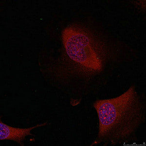Immunofluorescence staining of methanol-fixed Hela cells using ATF2(Ab-62 or 44) Antibody.Rabbit anti-Human ATF2 Polyclonal Antibody