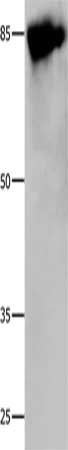 Gel: 10%SDS-PAGE, Lysate: 30 μg, Lane: 293T cells, Primary antibody: CALD1 Antibody(CALD1 Antibody) at dilution 1/800, Secondary antibody: Goat anti rabbit IgG at 1/8000 dilution, Exposure time: 30 seconds