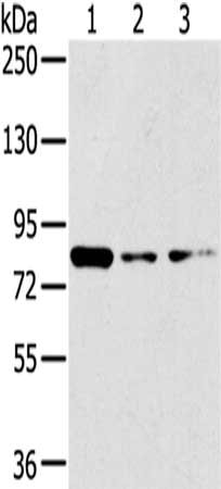 Gel: 6%SDS-PAGE,Lysate: 40 μg,Lane 1-3: A172 cells, 231 cells, Hela cells,Primary antibody: GPD2 Antibody(GPD2 Antibody) at dilution 1/200 dilution,Secondary antibody: Goat anti rabbit IgG at 1/8000 dilution,Exposure time: 30 secondsRabbit anti-Human GPD2 Polyclonal Antibody