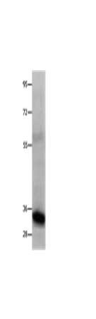 Gel: 10%SDS-PAGE, Lysate: 30μg, Lane: 293T cells, Primary antibody: COL2A1 Antibody(COL2A1 Antibody) at dilution 1/200, Secondary antibody: Goat anti rabbit IgG at 1/8000 dilution, Exposure time: 10 secondsRabbit anti-Human COL2A1 Polyclonal Antibody