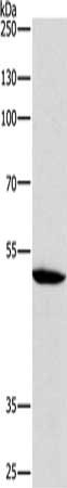 Gel: 10%SDS-PAGE, Lysate: 40 μg, Lane: 231 cells, Primary antibody: ATG4A Antibody(ATG4A Antibody) at dilution 1/210, Secondary antibody: Goat anti rabbit IgG at 1/8000 dilution, Exposure time: 2 minutes