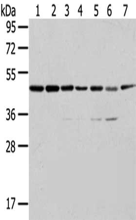 Gel: 8%SDS-PAGE,Lysate: 40 μg,Lane 1-7: A431 cells, K562 cells, 231 cells, HepG2 cells, Hela cells, A549 cells, Raji cells,Primary antibody: ERP44 Antibody(ERP44 Antibody) at dilution 1/200 dilution,Secondary antibody: Goat anti rabbit IgG at 1/8000 dilution,Exposure time: 10 secondsRabbit anti-Human ERP44 Polyclonal Antibody