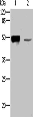 Gel: 8%SDS-PAGE, Lysate: 40 μg, Lane: Human normal liver tissue, Primary antibody: KRT31 Antibody(KRT31 Antibody) at dilution 1/200, Secondary antibody: Goat anti rabbit IgG at 1/8000 dilution, Exposure time: 10 seconds