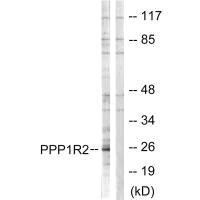 Western blot analysis of extracts from Jurkat cells, using PPP1R2 (Ab-120/121) antibody.