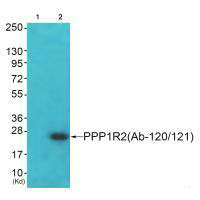 Western blot analysis of extracts from JK cells (Lane 2), using PPP1R2 (Ab-120/121) antiobdy. The lane on the left is treated with synthesized peptide.