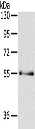 Gel: 6%SDS-PAGE,Lysate: 40 μg,,Primary antibody: PAK3 Antibody(PAK3 Antibody) at dilution 1/200 dilution,Secondary antibody: Goat anti rabbit IgG at 1/8000 dilution,Exposure time: 1 minuteRabbit anti-Human PAK3 Polyclonal Antibody