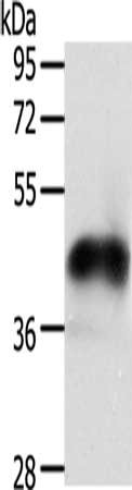 Gel: 12%SDS-PAGE, Lysate: 40 μg, Lane: PC3 cells, Primary antibody: NFKBIE Antibody(NFKBIE Antibody) at dilution 1/250, Secondary antibody: Goat anti rabbit IgG at 1/8000 dilution, Exposure time: 30 minutesRabbit anti-Human NFKBIE Polyclonal Antibody