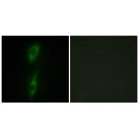 Immunofluorescence analysis of HeLa cells, using ACVL1 antibody.Rabbit anti-Human ACVRL1 Polyclonal Antibody
