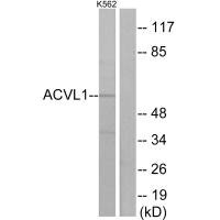 Western blot analysis of extracts from K562 cells, using ACVL1 antibody.Rabbit anti-Human ACVRL1 Polyclonal Antibody