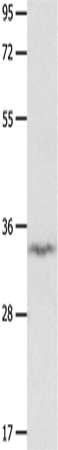 Gel: 10%SDS-PAGE, Lysate: 40 μg, Lane: Mouse brain tissue, Primary antibody: IGFBP7 Antibody(IGFBP7 Antibody) at dilution 1/400, Secondary antibody: Goat anti rabbit IgG at 1/8000 dilution, Exposure time: 1 minuteRabbit anti-Human IGFBP7 Polyclonal Antibody