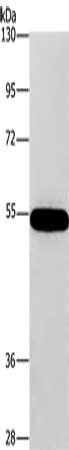 Gel: 8%SDS-PAGE, Lysate: 40 μg, Lane: 293T cells, Primary antibody: CNDP1 Antibody(CNDP1 Antibody) at dilution 1/320, Secondary antibody: Goat anti rabbit IgG at 1/8000 dilution, Exposure time: 10 secondsRabbit anti-Human CNDP1 Polyclonal Antibody