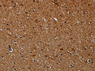 The image on the left is immunohistochemistry of paraffin-embedded Human brain  tissue using CYP1A2 Antibody(CYP1A2 Antibody) at dilution 1/40, on the right is treated with synthetic peptide. (Original magnification: ×200)Rabbit anti-Human CYP1A2 Polyclonal Antibody